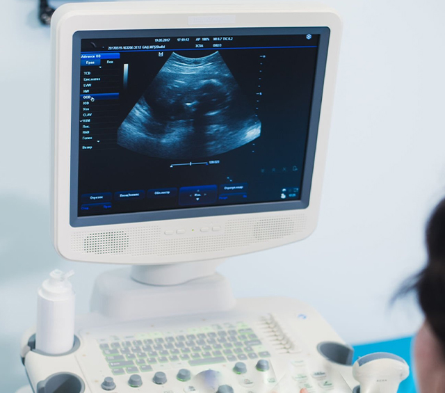 ultrasound imaging